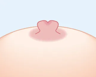 軽度の見た目