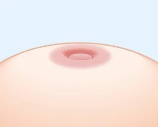 重度の見た目