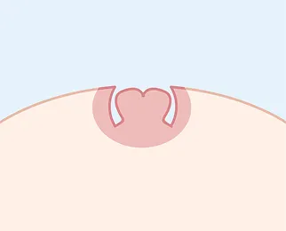 重度の断面